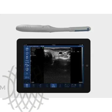 УЗИ аппарат ЕЛС-МЕД ЕЛС500 Мини
