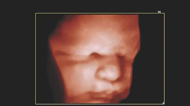 Клинические изображения Philips 5500 ультразвуковой аппарат портативный