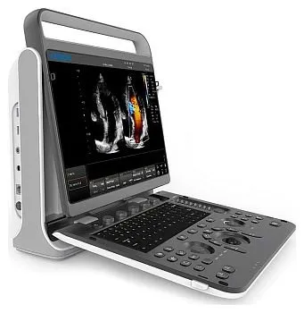 Портативный УЗИ аппарат Chison SonoTouch 60 Pro