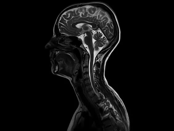 Клинические изображения Магнитно-резонансный томограф Siemens MAGNETOM Skyra 3T