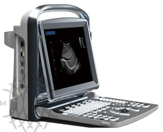 Chison SonoTouch 10 УЗИ аппарат портативный