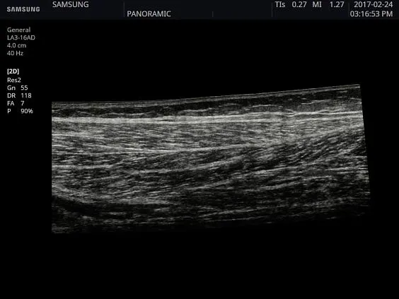 Клинические изображения Samsung Medison HS40 УЗИ аппарат