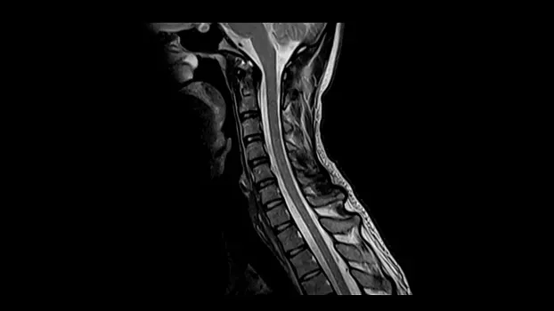 Клинические изображения Магнитно-резонансный томограф Siemens MAGNETOM Free.Max