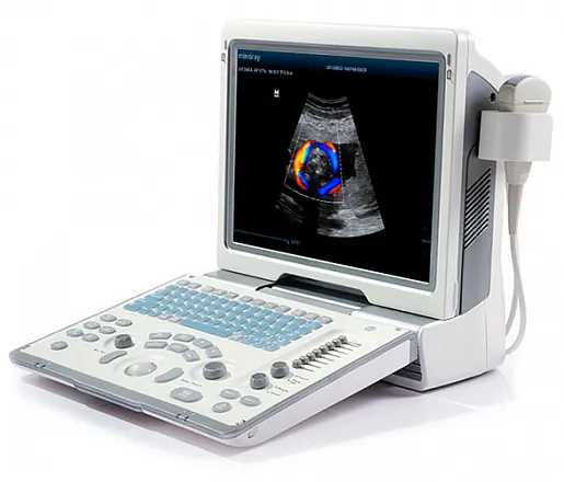 УЗИ аппарат Mindray DP-50 Color портативный