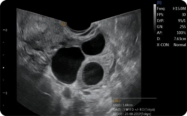 Клинические изображения Chison Qbit 6 ультразвуковой аппарат