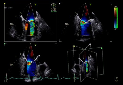 Клинические изображения Ультразвуковая диагностическая система GE HealthCare Vivid E95