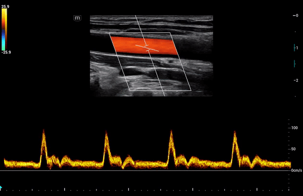 Клинические изображения УЗИ аппарат Mindray Consona N8