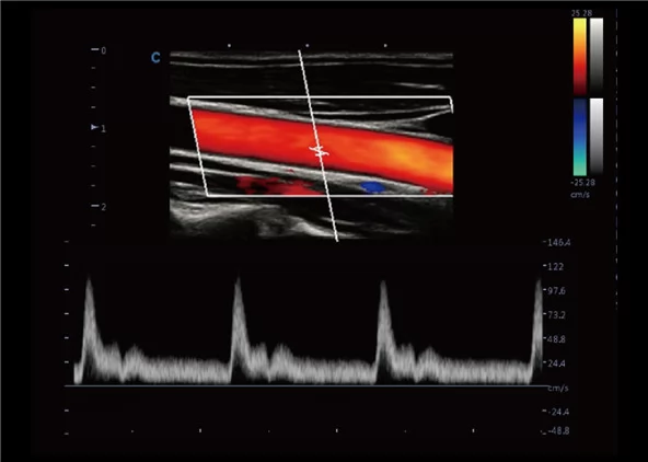 Клинические изображения УЗИ аппарат Chison CBit 9