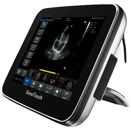 Chison SonoTouch 30 портативный УЗИ аппарат