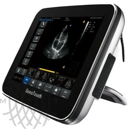 Chison SonoTouch 30 портативный УЗИ аппарат