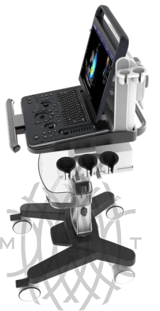 УЗИ аппарат Chison Sonotouch 60 OB портативный