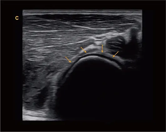 Клинические изображения Chison i9 ультразвуковой аппарат