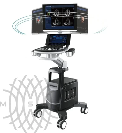 УЗИ аппарат Chison Qbit 11