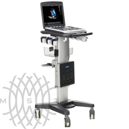 УЗИ аппарат Chison SonoTouch 80 портативный