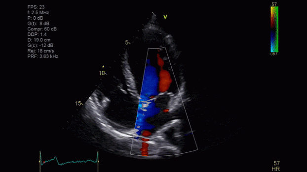 Клинические изображения Ультразвуковая диагностическая система GE HealthCare Vivid iQ портативная