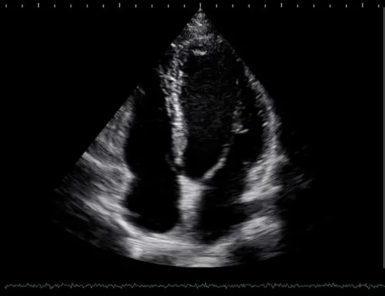 Клинические изображения УЗИ аппарат НПО СКАНЕР РУСКАН 65М