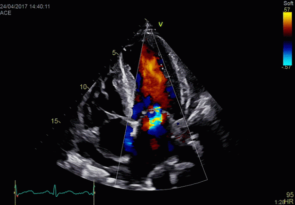 Клинические изображения Ультразвуковая диагностическая система GE HealthCare Vivid E95