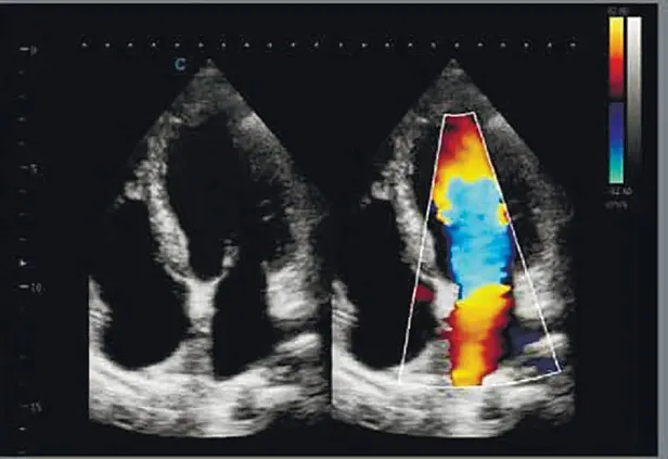 Клинические изображения УЗИ аппарат Chison Qbit 11