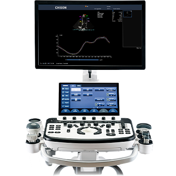 Chison XBit 90 ультразвуковой аппарат